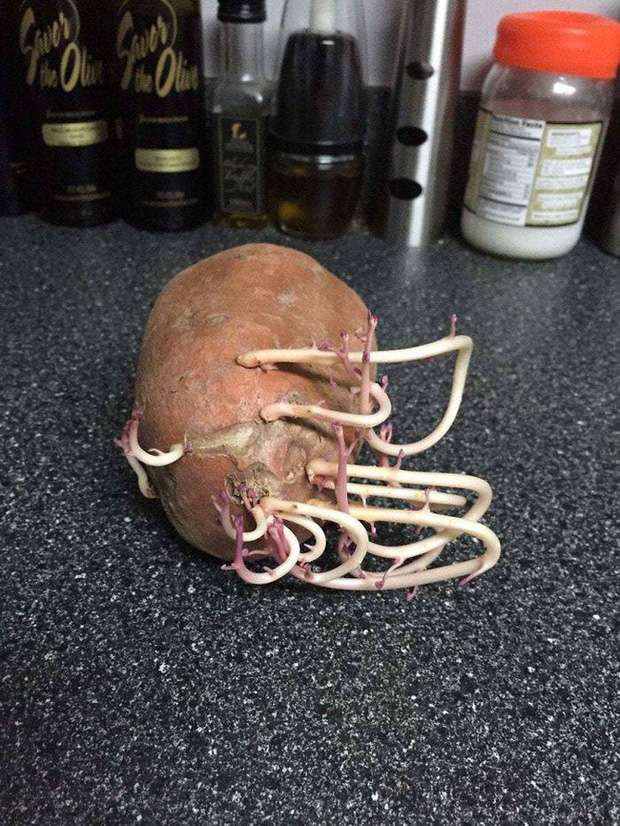 Chỉ một lần đãng trí, người phụ nữ phải lĩnh hậu quả thót tim và loạt ảnh chứng minh nhà nào cũng có thể tồn tại quái vật này nếu không cẩn thận - Ảnh 8. Chỉ một lần đãng trí, người phụ nữ phải lĩnh hậu quả thót tim và loạt ảnh chứng minh nhà nào cũng có thể tồn tại quái vật này nếu không cẩn thận - Ảnh 8.