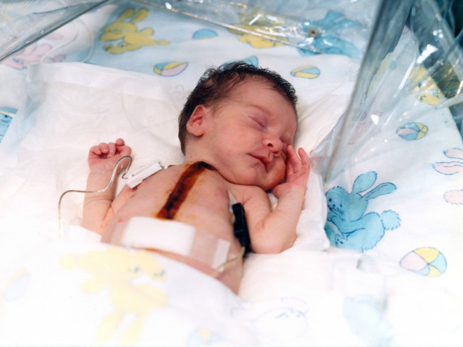 Bé gái hơn 10 ngày tuổi đã mang trong cơ thể trái tim của khỉ sau ca phẫu thuật cấy ghép phi thường khiến giới y khoa ngỡ ngàng - Ảnh 4. Bé gái hơn 10 ngày tuổi đã mang trong cơ thể trái tim của khỉ sau ca phẫu thuật cấy ghép phi thường khiến giới y khoa ngỡ ngàng - Ảnh 4.