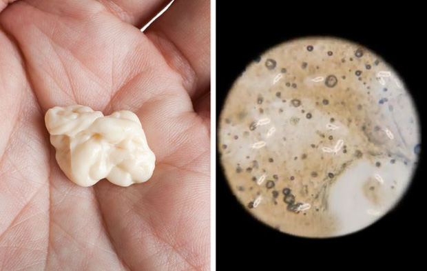 Loạt ảnh những vật dụng hằng ngày trong cuộc sống được soi dưới kính hiển vi khiến ai nhìn vào cũng phải kinh ngạc - Ảnh 15. Loạt ảnh những vật dụng hằng ngày trong cuộc sống được soi dưới kính hiển vi khiến ai nhìn vào cũng phải kinh ngạc - Ảnh 15.