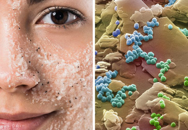 Loạt ảnh những vật dụng hằng ngày trong cuộc sống được soi dưới kính hiển vi khiến ai nhìn vào cũng phải kinh ngạc - Ảnh 6. Loạt ảnh những vật dụng hằng ngày trong cuộc sống được soi dưới kính hiển vi khiến ai nhìn vào cũng phải kinh ngạc - Ảnh 6.