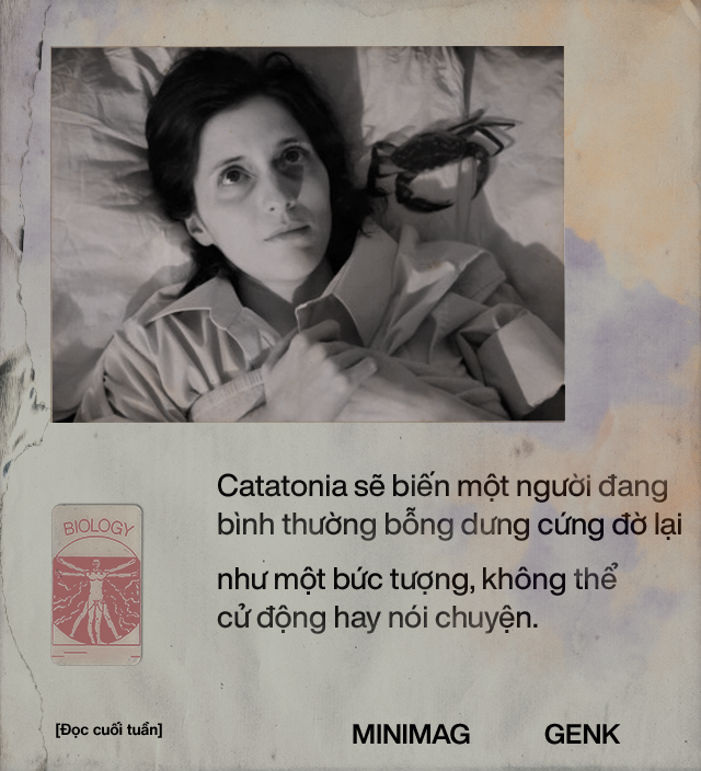 Đọc cuối tuần: 100 năm hội chứng bí ẩn bị lãng quên, khiến những người mắc phải nó hóa thành tượng đá - Ảnh 1. Đọc cuối tuần: 100 năm hội chứng bí ẩn bị lãng quên, khiến những người mắc phải nó hóa thành tượng đá - Ảnh 1.