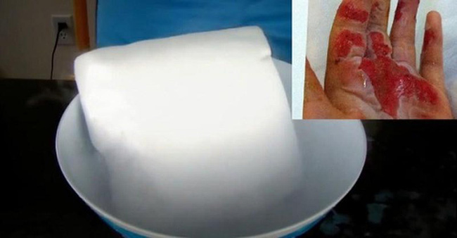 Đổ đ&aacute; kh&ocirc; xuống bể bơi trong tiệc sinh nhật, sao Instagram khiến 3 người chết thảm: Đ&aacute; kh&ocirc; nguy hiểm thế n&agrave;o v&agrave; cần lưu &yacute; g&igrave; khi sử dụng? - Ảnh 5.