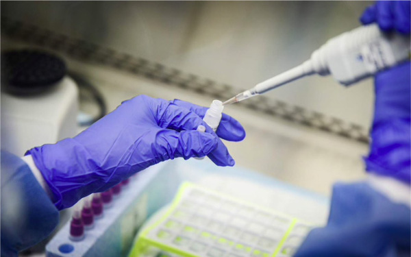 Đức t&igrave;m ra c&aacute;ch tăng 10 lần năng lực x&eacute;t nghiệm COVID-19 - Ảnh 1.