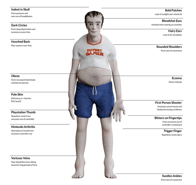 Nếu chơi game h&agrave;ng chục tiếng mỗi ng&agrave;y, cơ thể người nghiện game sẽ thay đổi thế n&agrave;o sau 20 năm nữa? - Ảnh 1.