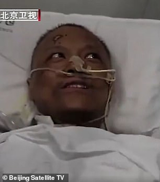  Hai b&aacute;c sĩ Trung Quốc c&oacute; l&agrave;n da bị đổi sang m&agrave;u n&acirc;u sau một thời gian d&agrave;i chống chọi với Covid-19  - Ảnh 3.