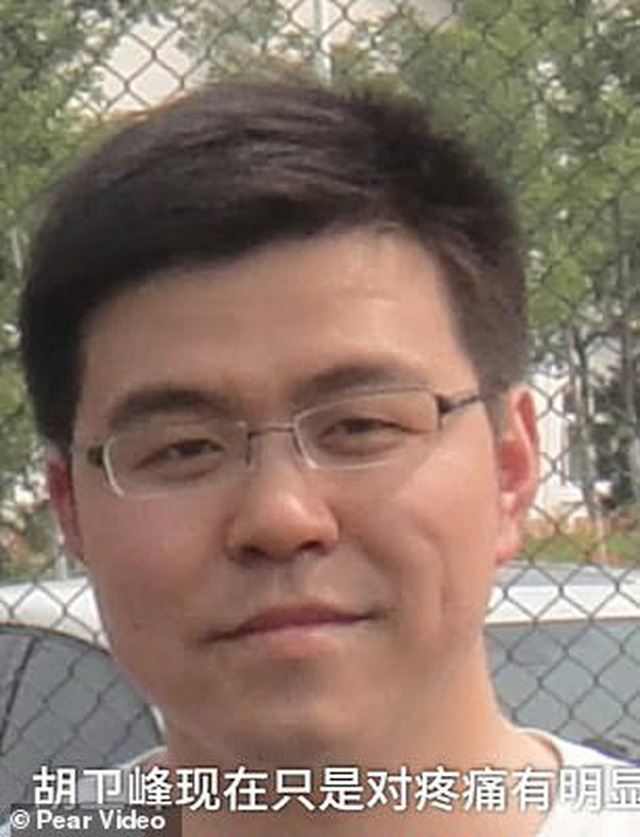  Hai b&aacute;c sĩ Trung Quốc c&oacute; l&agrave;n da bị đổi sang m&agrave;u n&acirc;u sau một thời gian d&agrave;i chống chọi với Covid-19  - Ảnh 4.