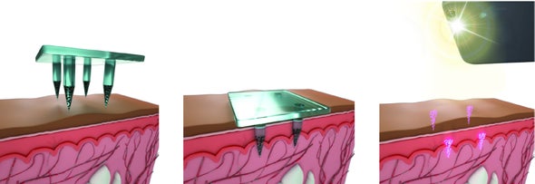 Lật tẩy những thuyết âm mưu vô lý về Bill Gates - Ảnh 3. Lật tẩy những thuyết âm mưu vô lý về Bill Gates - Ảnh 3.