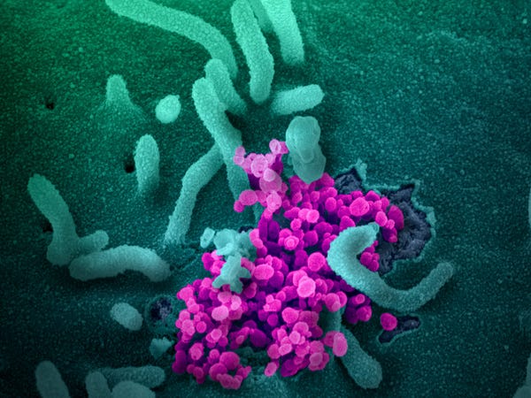 C&aacute;c nh&agrave; khoa học t&igrave;m thấy một protein phản loạn trong cơ thể, kẻ mở cổng th&agrave;nh đ&oacute;n giặc SARS-CoV-2 v&agrave;o trong tế b&agrave;o - Ảnh 1.