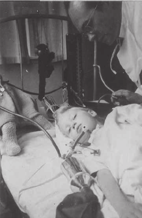 Lịch sử của m&aacute;y thở v&agrave; đơn vị chăm s&oacute;c t&iacute;ch cực ICU: Những h&ograve;n đảo sống trong đại dịch COVID-19 - Ảnh 5.