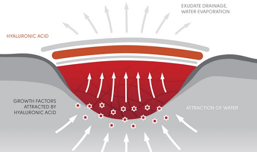 Đột ph&aacute;: C&aacute;c nh&agrave; khoa học ph&aacute;t minh ra loại gel c&oacute; thể h&agrave;n gắn mọi vết thương tr&ecirc;n cơ thể v&agrave; trong cả nội tạng - Ảnh 4.
