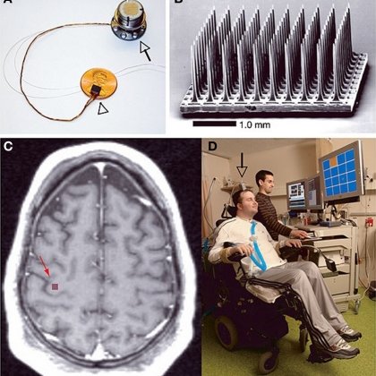 Th&iacute; nghiệm đầu ti&ecirc;n trong lịch sử chứng minh bộ n&atilde;o tự ph&aacute;t lại k&yacute; ức trong ng&agrave;y khi bạn ngủ - Ảnh 2.