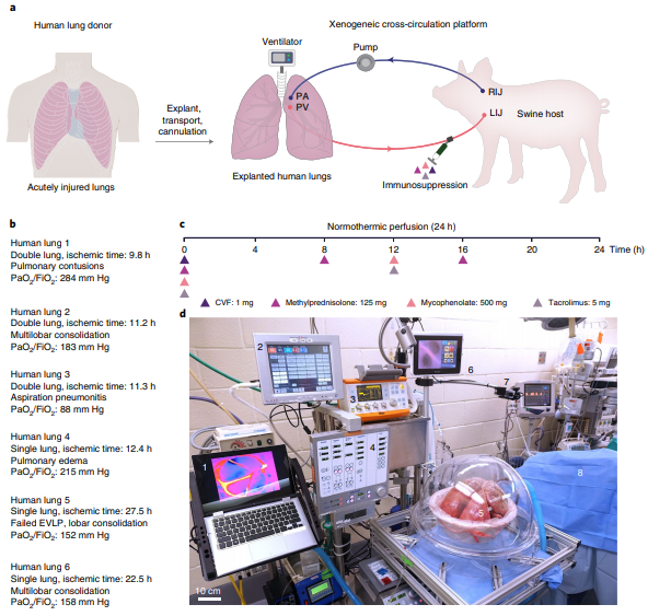 Đột ph&aacute;: Phổi người tổn thương được chữa l&agrave;nh sau 24 giờ nối v&agrave;o cơ thể lợn - Ảnh 2.
