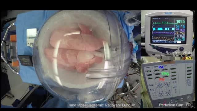 Đột ph&aacute;: Phổi người tổn thương được chữa l&agrave;nh sau 24 giờ nối v&agrave;o cơ thể lợn - Ảnh 4.