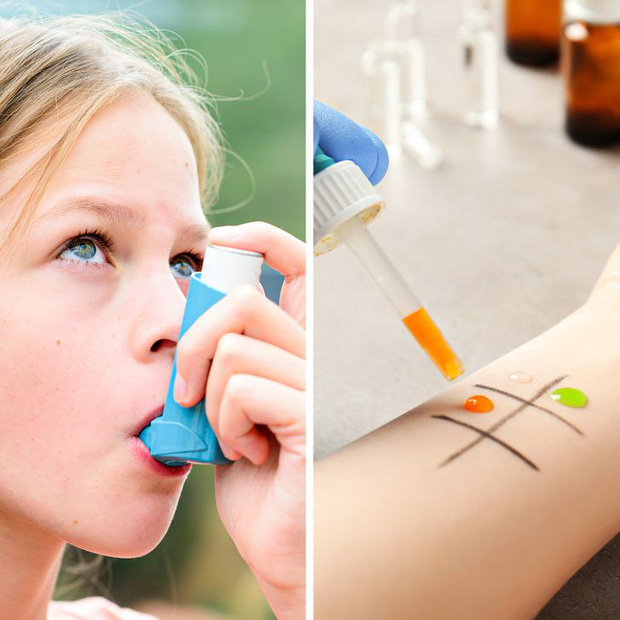 7 đặc điểm cho thấy con người chúng ta vẫn đang tiếp tục tiến hóa, nhưng nó không tốt đẹp như bạn nghĩ đâu - Ảnh 6. 7 đặc điểm cho thấy con người chúng ta vẫn đang tiếp tục tiến hóa, nhưng nó không tốt đẹp như bạn nghĩ đâu - Ảnh 6.