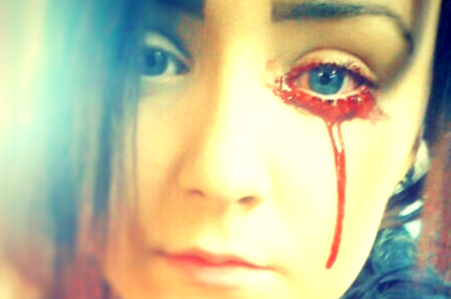 Giải m&atilde; b&iacute; ẩn của haemolacria: Chứng bệnh khiến những c&ocirc; g&aacute;i Ấn Độ kh&oacute;c ra m&aacute;u - Ảnh 5.