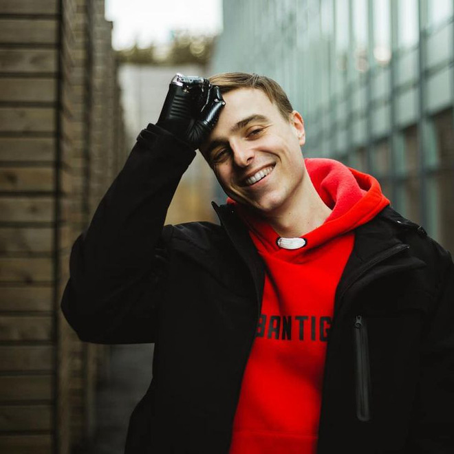 Tôi là một cyborg: Câu chuyện về chàng trai đánh mất cả hai bàn tay và cách anh biến cuộc đời mình trở nên cực kỳ có ý nghĩa - Ảnh 1. Tôi là một cyborg: Câu chuyện về chàng trai đánh mất cả hai bàn tay và cách anh biến cuộc đời mình trở nên cực kỳ có ý nghĩa - Ảnh 1.