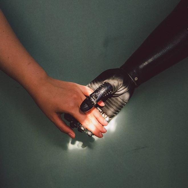 Tôi là một cyborg: Câu chuyện về chàng trai đánh mất cả hai bàn tay và cách anh biến cuộc đời mình trở nên cực kỳ có ý nghĩa - Ảnh 2. Tôi là một cyborg: Câu chuyện về chàng trai đánh mất cả hai bàn tay và cách anh biến cuộc đời mình trở nên cực kỳ có ý nghĩa - Ảnh 2.