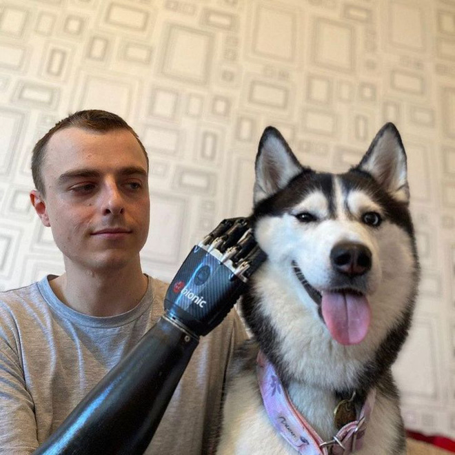 Tôi là một cyborg: Câu chuyện về chàng trai đánh mất cả hai bàn tay và cách anh biến cuộc đời mình trở nên cực kỳ có ý nghĩa - Ảnh 4. Tôi là một cyborg: Câu chuyện về chàng trai đánh mất cả hai bàn tay và cách anh biến cuộc đời mình trở nên cực kỳ có ý nghĩa - Ảnh 4.