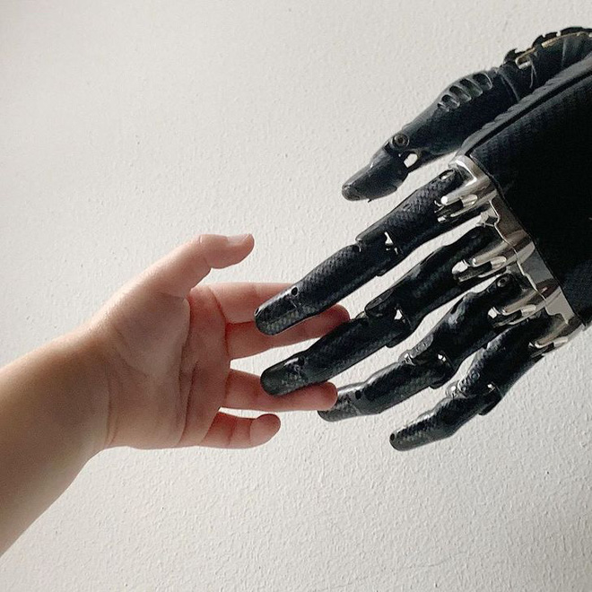 Tôi là một cyborg: Câu chuyện về chàng trai đánh mất cả hai bàn tay và cách anh biến cuộc đời mình trở nên cực kỳ có ý nghĩa - Ảnh 5. Tôi là một cyborg: Câu chuyện về chàng trai đánh mất cả hai bàn tay và cách anh biến cuộc đời mình trở nên cực kỳ có ý nghĩa - Ảnh 5.