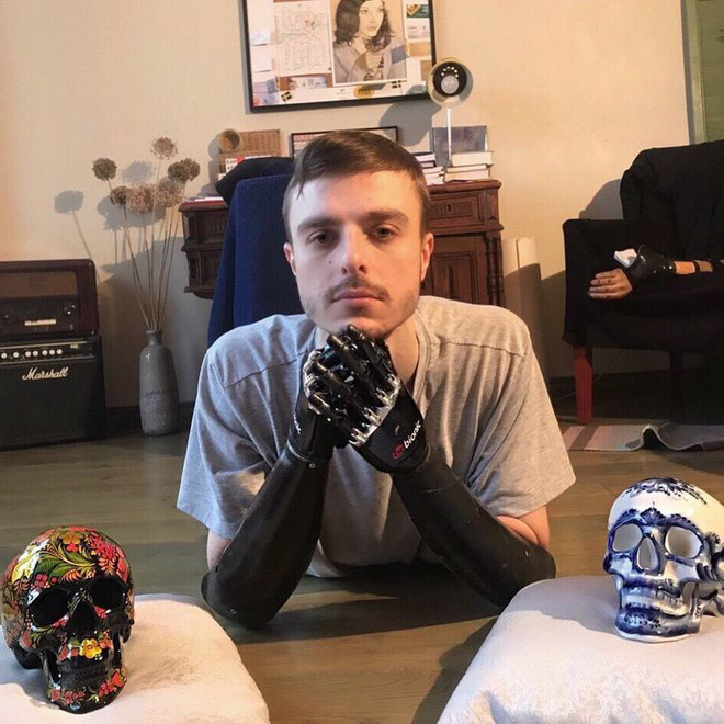 Tôi là một cyborg: Câu chuyện về chàng trai đánh mất cả hai bàn tay và cách anh biến cuộc đời mình trở nên cực kỳ có ý nghĩa - Ảnh 6. Tôi là một cyborg: Câu chuyện về chàng trai đánh mất cả hai bàn tay và cách anh biến cuộc đời mình trở nên cực kỳ có ý nghĩa - Ảnh 6.