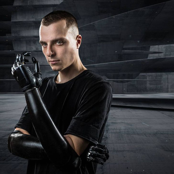 Tôi là một cyborg: Câu chuyện về chàng trai đánh mất cả hai bàn tay và cách anh biến cuộc đời mình trở nên cực kỳ có ý nghĩa - Ảnh 8. Tôi là một cyborg: Câu chuyện về chàng trai đánh mất cả hai bàn tay và cách anh biến cuộc đời mình trở nên cực kỳ có ý nghĩa - Ảnh 8.