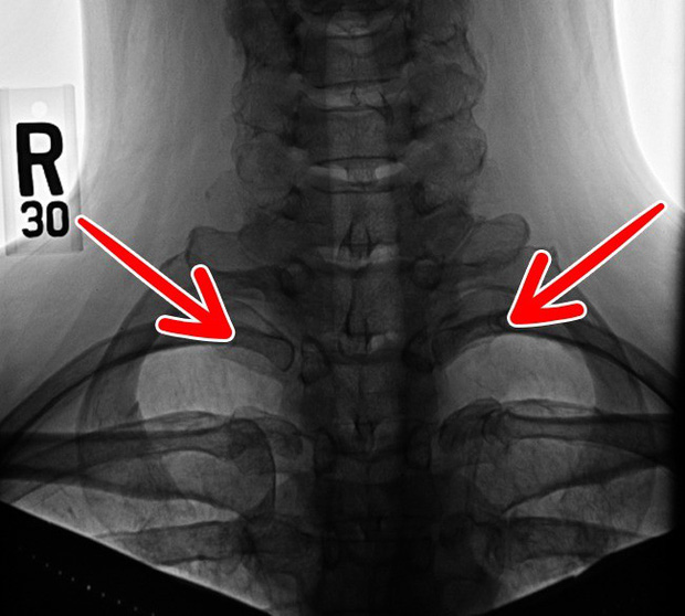 10 bộ phận cơ thể sẽ biến mất trong tương lai, cái số 4 ai nghe xong cũng mừng - Ảnh 5. 10 bộ phận cơ thể sẽ biến mất trong tương lai, cái số 4 ai nghe xong cũng mừng - Ảnh 5.