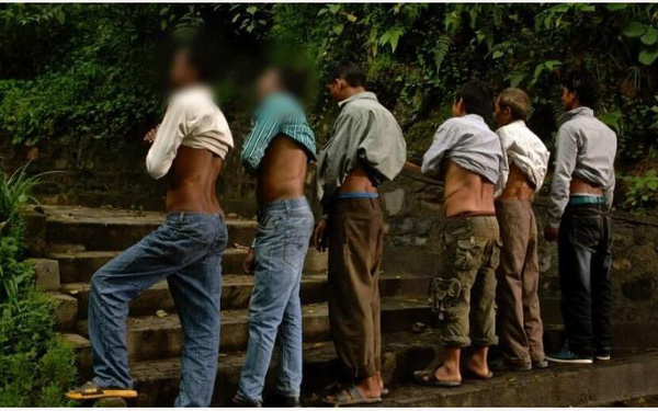 Ngôi làng ở Nepal nơi mỗi người chỉ có một quả thận - Ảnh 1. Ngôi làng ở Nepal nơi mỗi người chỉ có một quả thận - Ảnh 1.