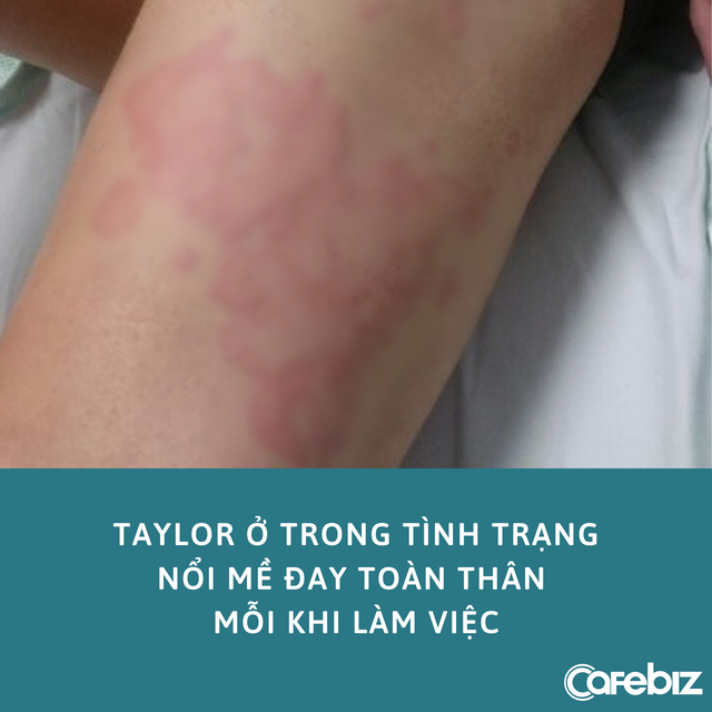 C&ocirc; g&aacute;i mắc bệnh dị ứng nặng với... c&ocirc;ng việc, bỏ l&agrave;m chu du khắp thế giới liền khỏi bệnh - Ảnh 2.