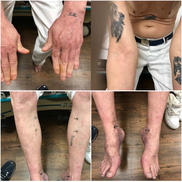 Tử t&ugrave; đất Mỹ: Bị ti&ecirc;m thuốc độc nhưng m&atilde;i kh&ocirc;ng chịu chết! - Ảnh 3.