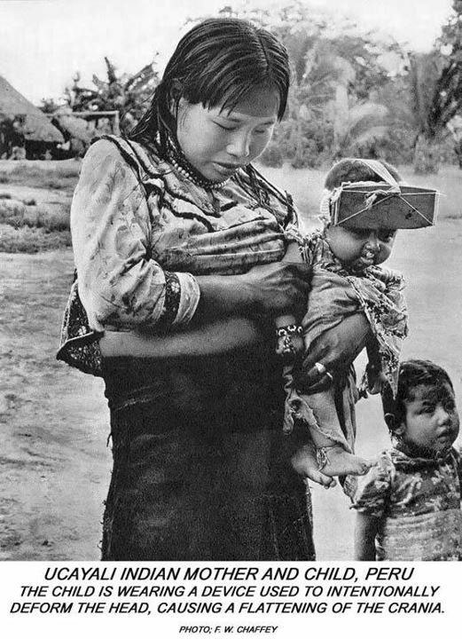 Những hộp sọ kỳ lạ nhất từng được phát hiện trong lịch sử - Ảnh 2. Những hộp sọ kỳ lạ nhất từng được phát hiện trong lịch sử - Ảnh 2.