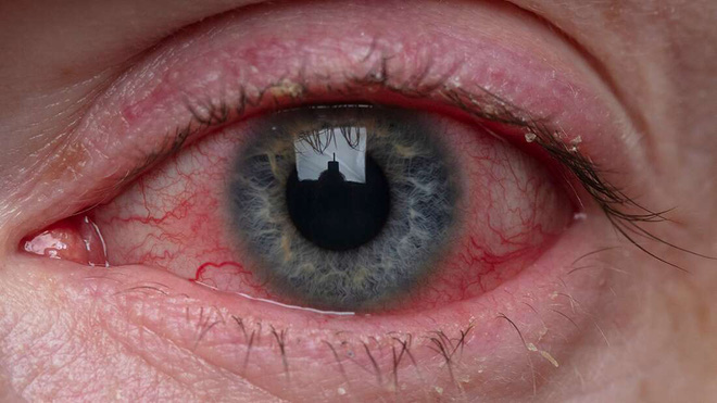 Thiếu niên thức trắng 11 đêm để phục vụ khoa học, và đây là những gì đã xảy ra - Ảnh 2. Thiếu niên thức trắng 11 đêm để phục vụ khoa học, và đây là những gì đã xảy ra - Ảnh 2.