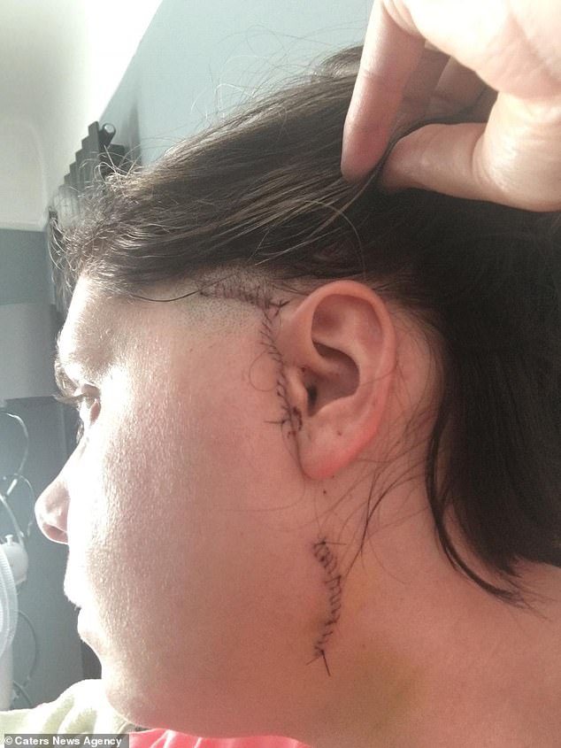 Người phụ nữ Mỹ phải thay cả h&agrave;m dưới v&igrave; cố gắng cắn miếng b&aacute;nh m&igrave; kẹp thịt KFC si&ecirc;u to khổng lồ - Ảnh 2.