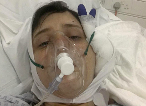 Người phụ nữ Mỹ phải thay cả hàm dưới vì cố gắng cắn miếng bánh mì kẹp thịt KFC siêu to khổng lồ - Ảnh 4. Người phụ nữ Mỹ phải thay cả hàm dưới vì cố gắng cắn miếng bánh mì kẹp thịt KFC siêu to khổng lồ - Ảnh 4.