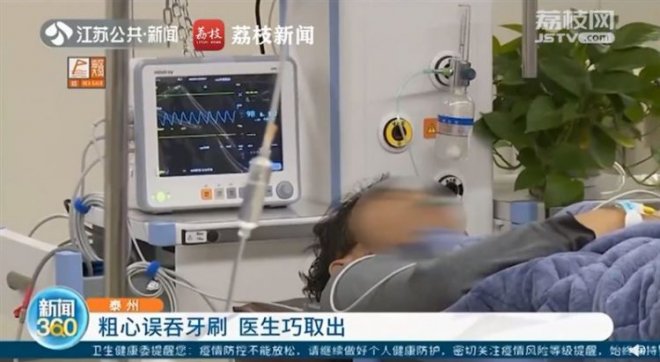 Đ&aacute;nh răng trong l&uacute;c c&ograve;n đang ng&aacute;i ngủ, người đ&agrave;n &ocirc;ng Trung Quốc v&ocirc; t&igrave;nh nuốt cả chiếc b&agrave;n chải v&agrave;o bụng - Ảnh 1.