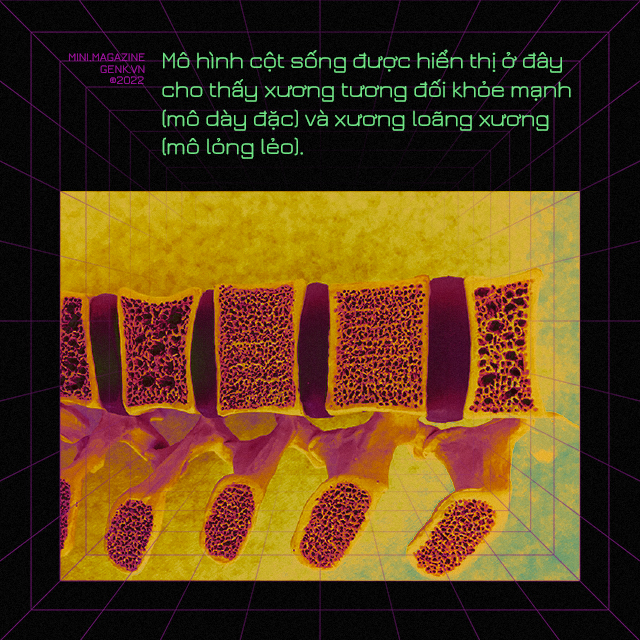 [mini] Ng&ocirc;n ngữ của những bộ xương v&agrave; những điều th&uacute; vị chưa biết - Ảnh 8.