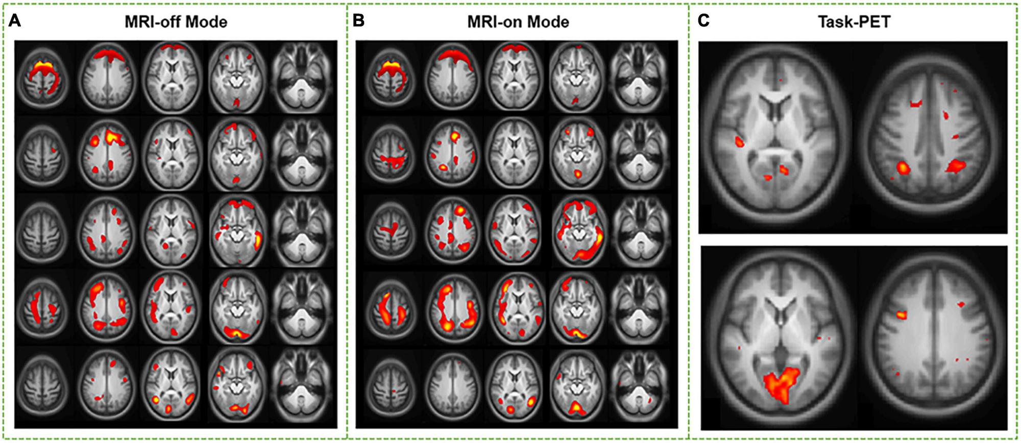 Không phải 10% bộ não, con người đang sử dụng bộ phận này với bao nhiêu công suất? - Ảnh 4. Không phải 10% bộ não, con người đang sử dụng bộ phận này với bao nhiêu công suất? - Ảnh 4.