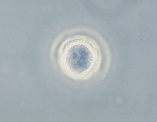 Những lo&agrave;i k&yacute; sinh tr&ugrave;ng nguy hiểm nhất ở người từng được ph&aacute;t hiện! - Ảnh 6.