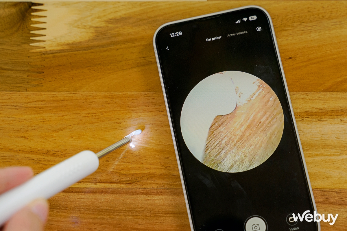 Dùng thử ngoáy tai gắn camera Xiaomi Bebird R1: Rẻ mà "ngon", dùng tiện, ngoáy sạch, kèm cả nhạc du dương- Ảnh 5. Dùng thử ngoáy tai gắn camera Xiaomi Bebird R1: Rẻ mà "ngon", dùng tiện, ngoáy sạch, kèm cả nhạc du dương- Ảnh 5.