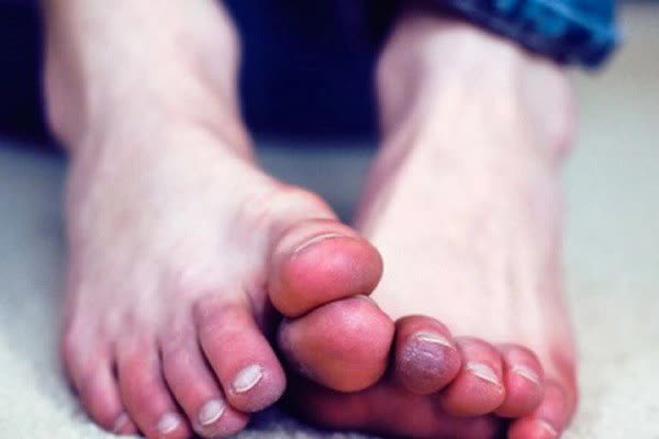 Người sống thọ sẽ có 3 biểu hiện này khi ngủ: Sáng dậy làm thêm 2 việc, gan và thận sẽ thầm cảm ơn bạn - Ảnh 2. Người sống thọ sẽ có 3 biểu hiện này khi ngủ: Sáng dậy làm thêm 2 việc, gan và thận sẽ thầm cảm ơn bạn - Ảnh 2.