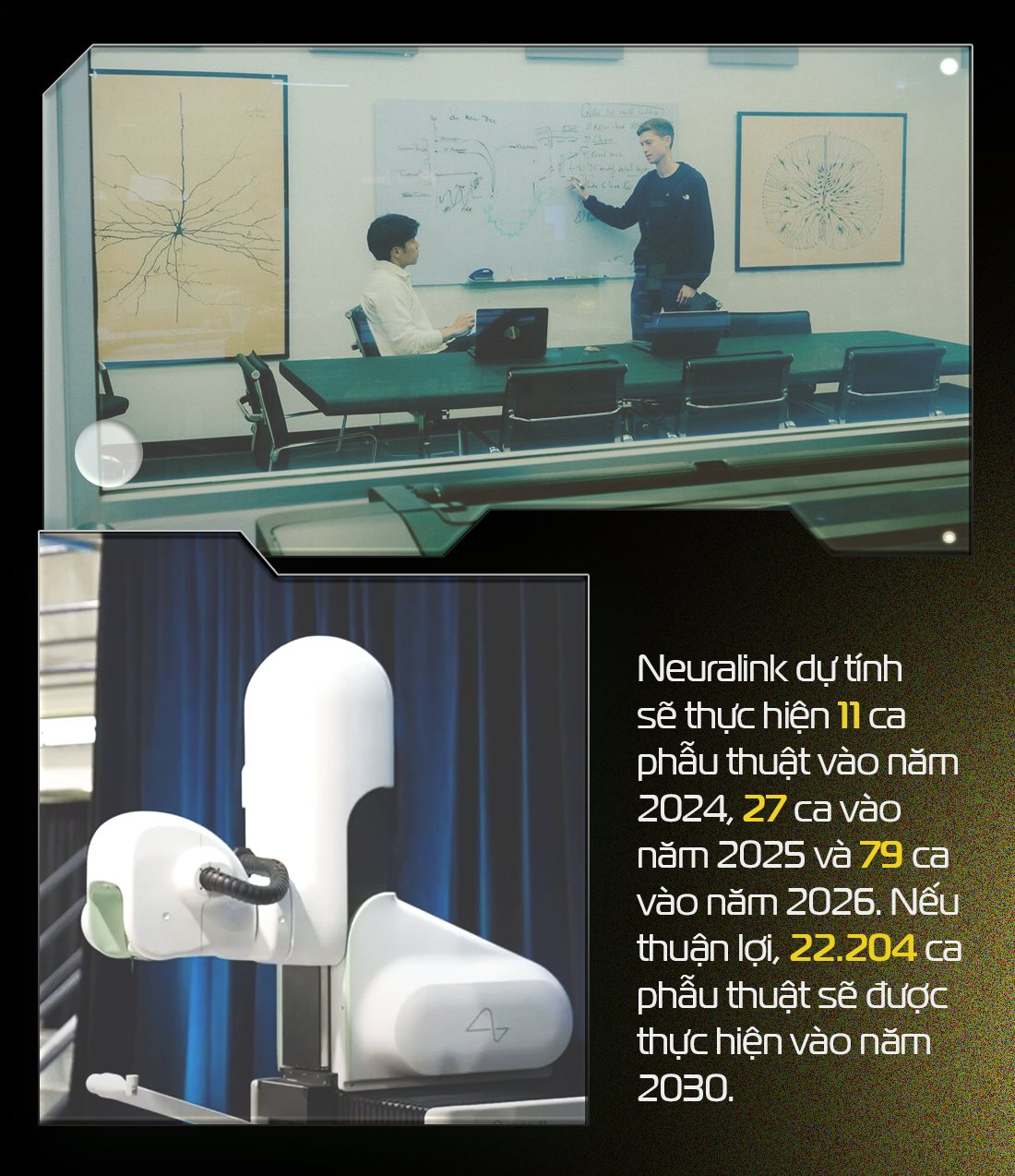 Giấc mơ cấy chip v&agrave;o n&atilde;o người đi&ecirc;n rồ của Elon Musk: Tự chế tạo robot phẫu thuật, sẽ thực hiện hơn 22.000 cuộc giải phẫu v&agrave;o năm 2030, chi ph&iacute; mỗi ca 10.000 USD - Ảnh 7.