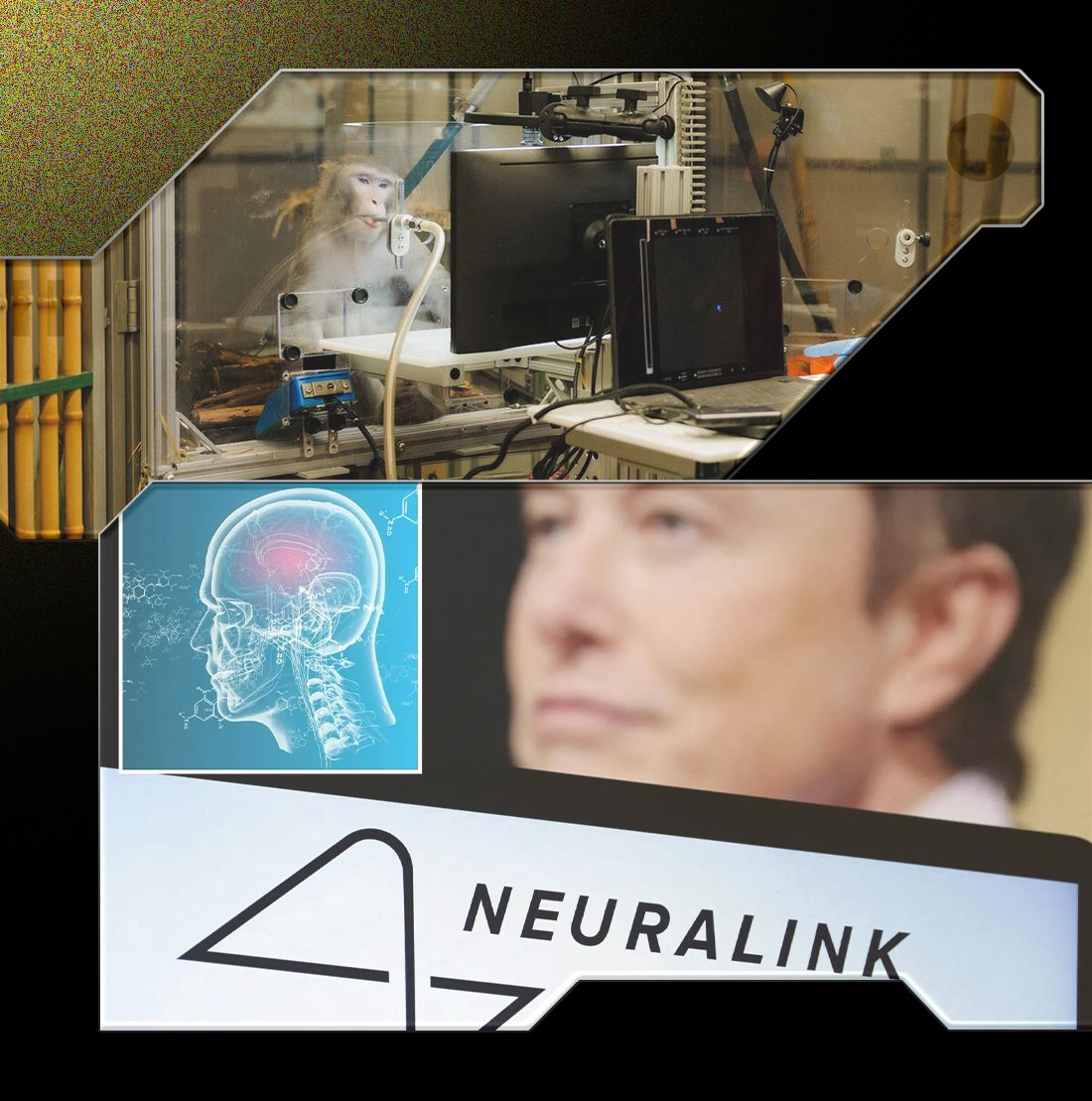 Giấc mơ cấy chip v&agrave;o n&atilde;o người đi&ecirc;n rồ của Elon Musk: Tự chế tạo robot phẫu thuật, sẽ thực hiện hơn 22.000 cuộc giải phẫu v&agrave;o năm 2030, chi ph&iacute; mỗi ca 10.000 USD - Ảnh 4.