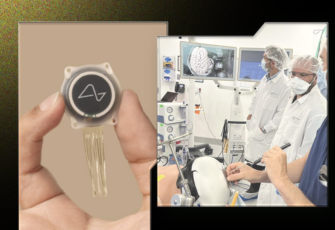 Giấc mơ cấy chip v&agrave;o n&atilde;o người đi&ecirc;n rồ của Elon Musk: Tự chế tạo robot phẫu thuật, sẽ thực hiện hơn 22.000 cuộc giải phẫu v&agrave;o năm 2030, chi ph&iacute; mỗi ca 10.000 USD - Ảnh 6.