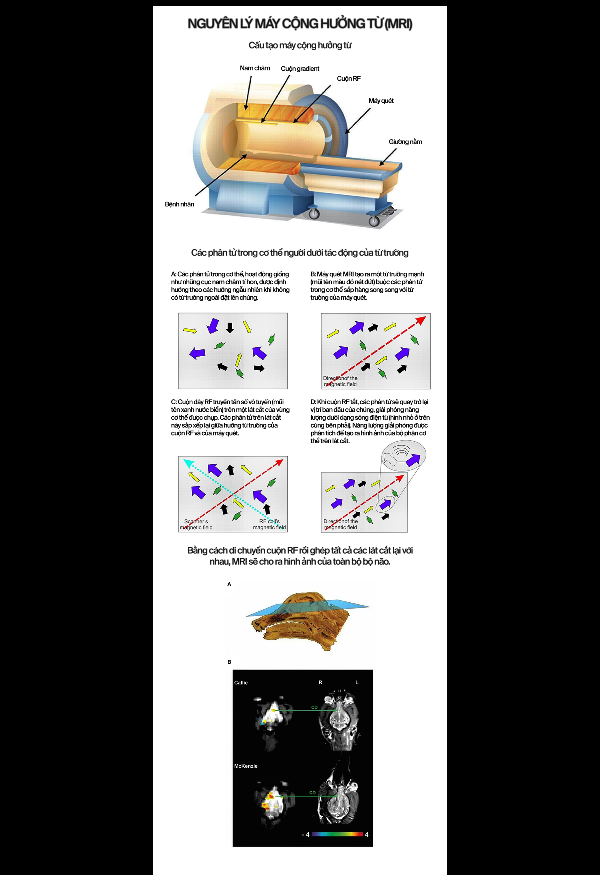 Bệnh nh&acirc;n 23: Anh c&oacute; muốn được chết kh&ocirc;ng? Đ&acirc;y l&agrave; c&aacute;ch những cỗ m&aacute;y đọc suy nghĩ gi&uacute;p người bị "nhốt hồn" cất tiếng n&oacute;i - Ảnh 17.