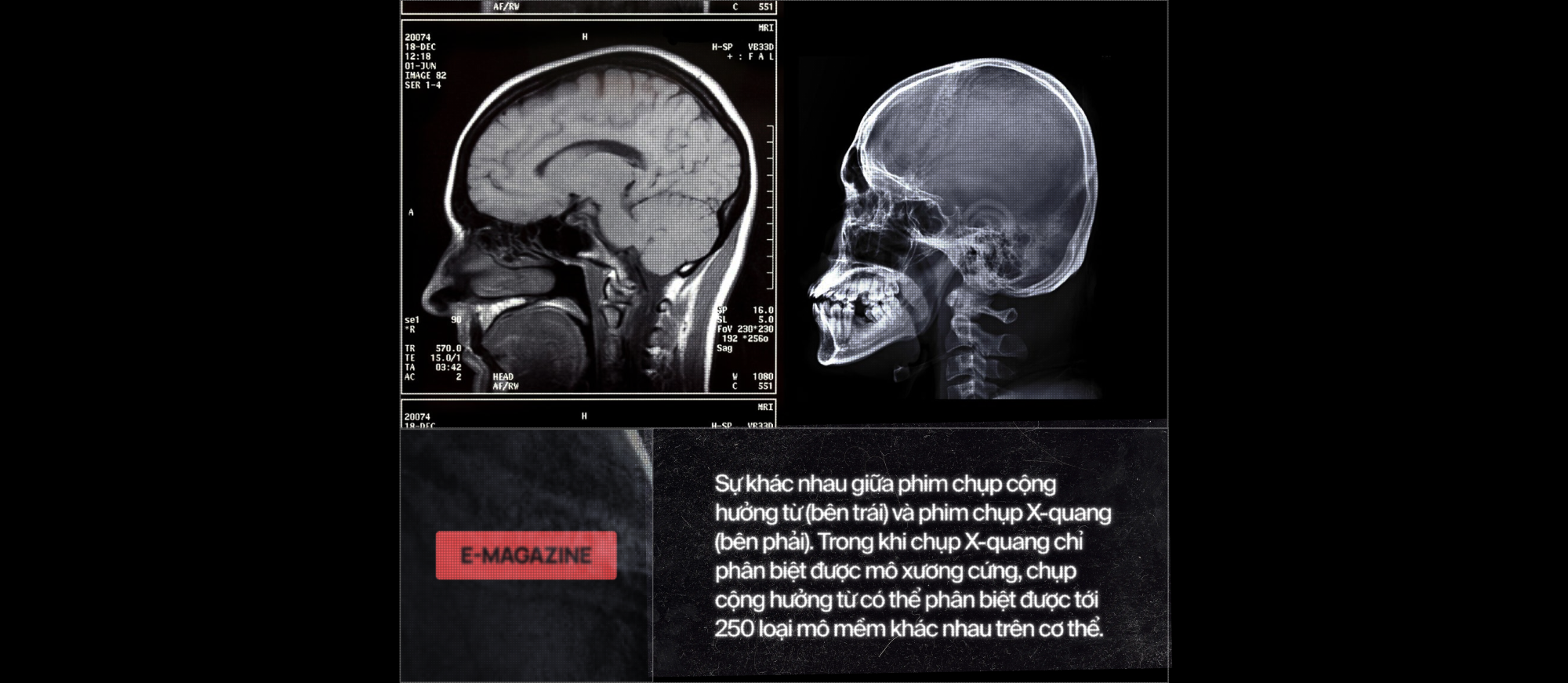 120 năm giấc mơ về một cỗ m&aacute;y đọc suy nghĩ, v&agrave; b&acirc;y giờ, ch&uacute;ng đ&atilde; ở đ&acirc;y - Ảnh 15.