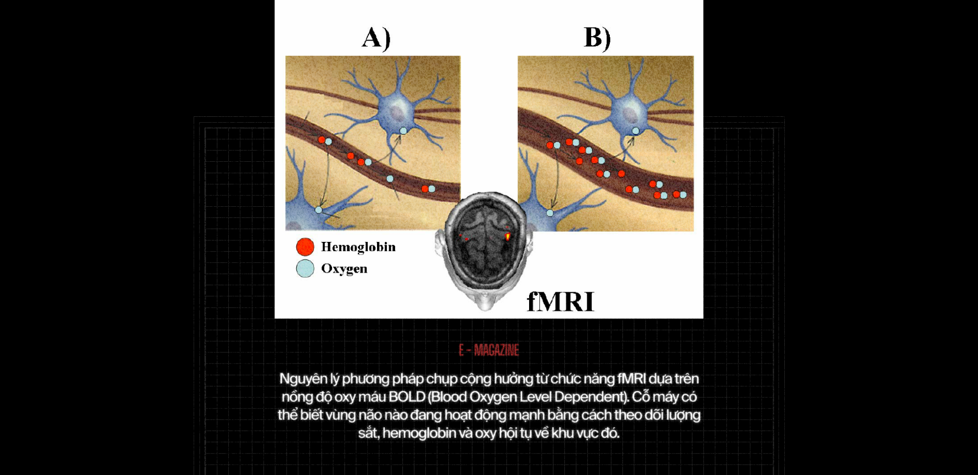 120 năm giấc mơ về một cỗ m&aacute;y đọc suy nghĩ, v&agrave; b&acirc;y giờ, ch&uacute;ng đ&atilde; ở đ&acirc;y - Ảnh 16.