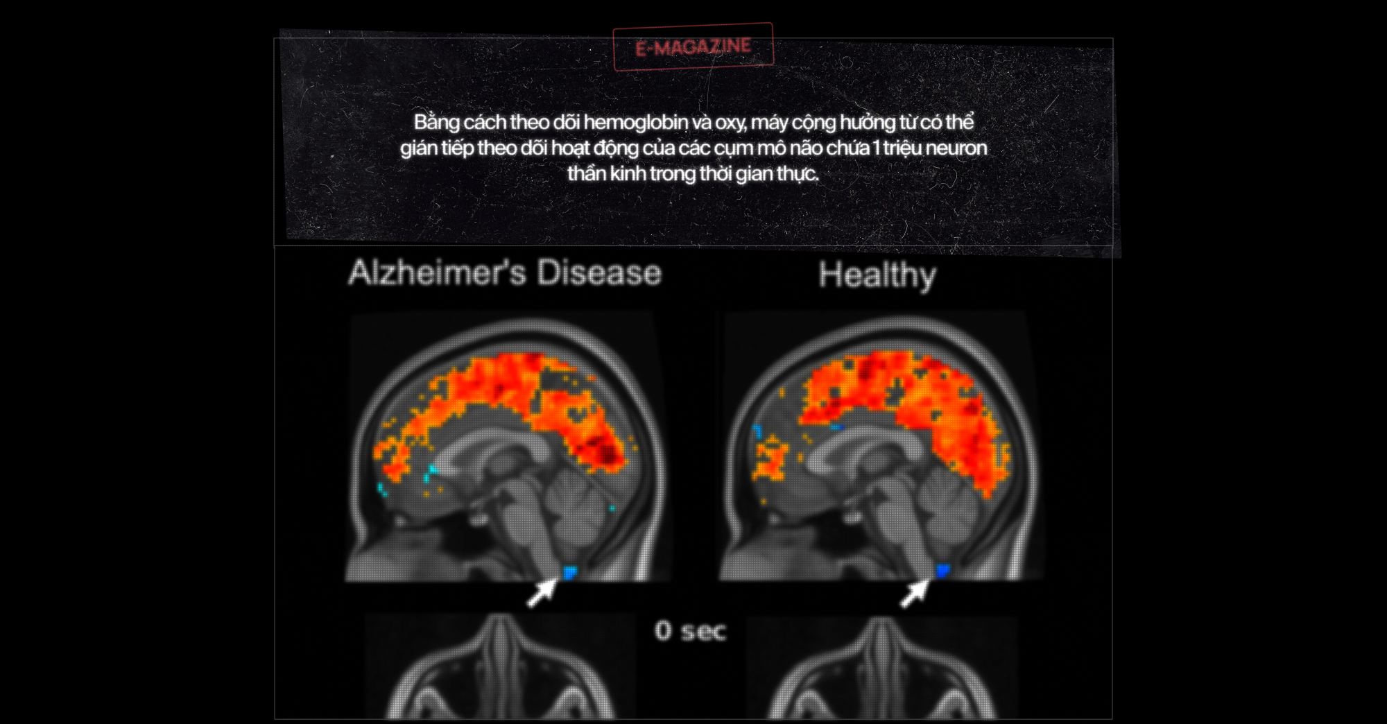 120 năm giấc mơ về một cỗ m&aacute;y đọc suy nghĩ, v&agrave; b&acirc;y giờ, ch&uacute;ng đ&atilde; ở đ&acirc;y - Ảnh 17.