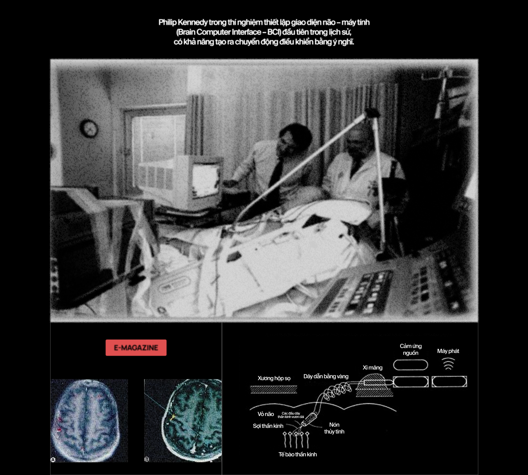 120 năm giấc mơ về một cỗ m&aacute;y đọc suy nghĩ, v&agrave; b&acirc;y giờ, ch&uacute;ng đ&atilde; ở đ&acirc;y - Ảnh 18.