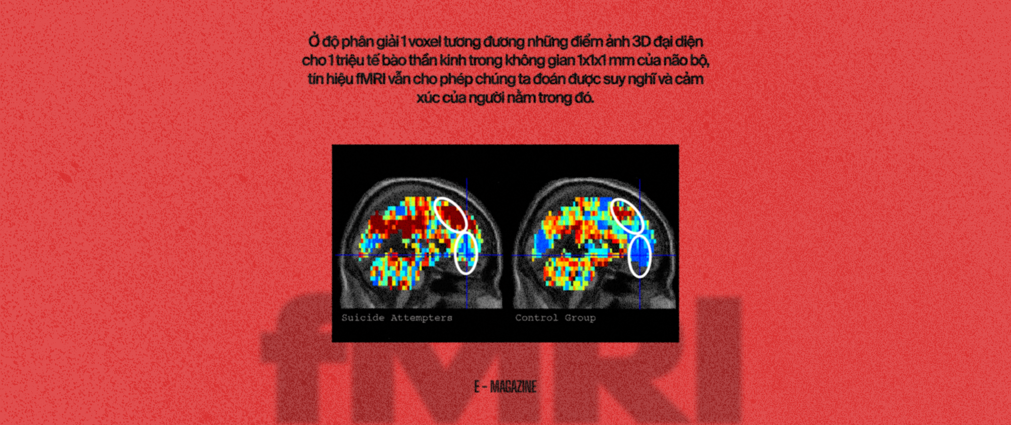 120 năm giấc mơ về một cỗ m&aacute;y đọc suy nghĩ, v&agrave; b&acirc;y giờ, ch&uacute;ng đ&atilde; ở đ&acirc;y - Ảnh 29.