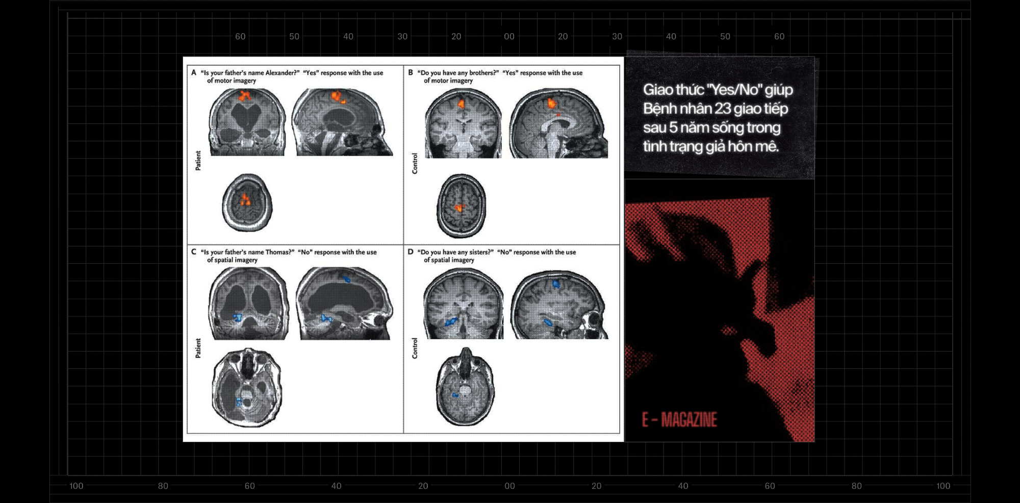 Bệnh nh&acirc;n 23: Anh c&oacute; muốn được chết kh&ocirc;ng? Đ&acirc;y l&agrave; c&aacute;ch những cỗ m&aacute;y đọc suy nghĩ gi&uacute;p người "nhốt hồn" cất tiếng n&oacute;i - Ảnh 8.