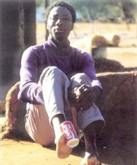 Bí ẩn về bộ tộc 'đà điểu': Không thể đi giày vì thiếu ngón chân! - Ảnh 4. Bí ẩn về bộ tộc 'đà điểu': Không thể đi giày vì thiếu ngón chân! - Ảnh 4.